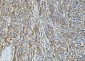 Anti-ICAM1 Antibody Picoband™ (monoclonal, 6F2C3)